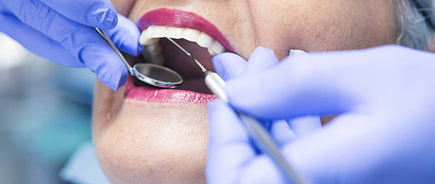 Best Emergency Treatment for Dental Infections or Abscesses in Christiansburg, VA