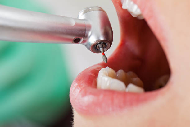 Best Same-Day Emergency Dental Services in Christiansburg, VA